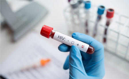 HIV Virüsü Belirtileri